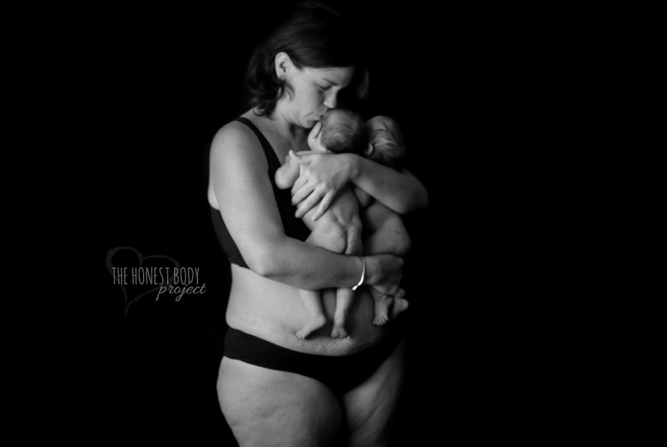 Honest Photo Series Shows The Reality Of Postpartum Body Image