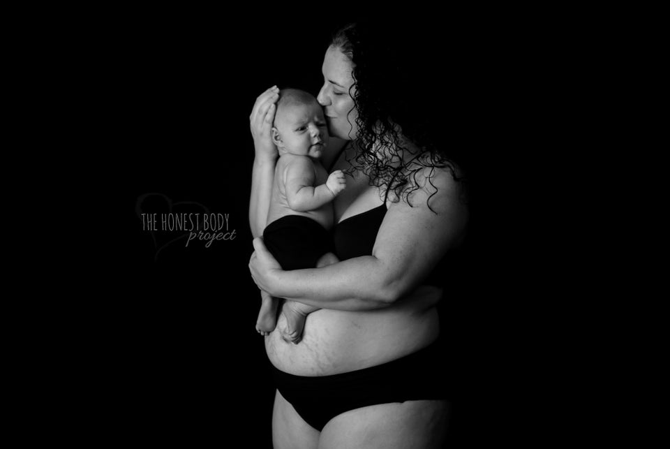 21 Awesome Photos That Show How Different Postpartum Bodies Can Look