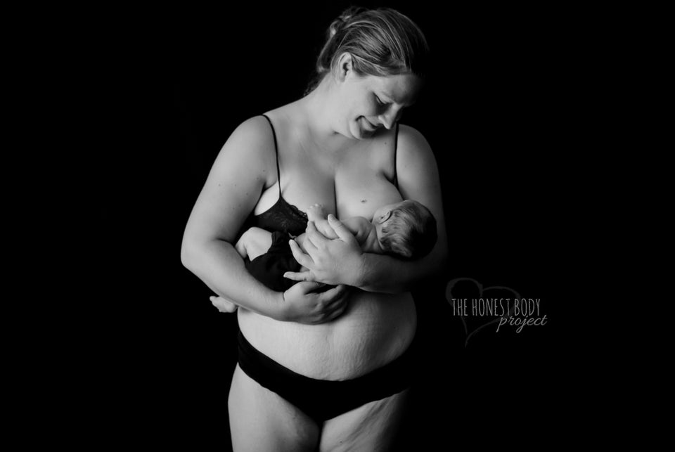 We Are Living for This Campaign Featuring Real Postpartum Bodies