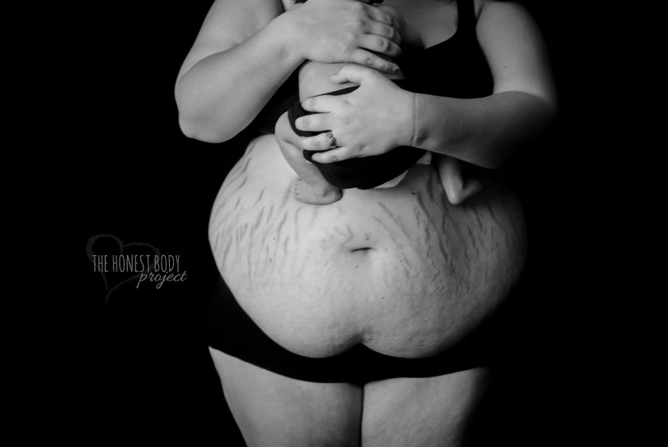 Post-Pregnancy Photo Series Shows How Mothers' Bodies Look After