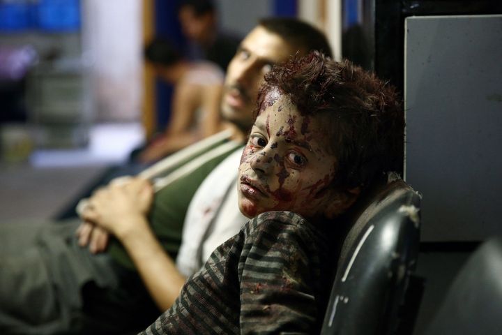 A Syrian boy waits to receive treatment at a makeshift hospital following reported airstrikes by government forces in the rebel-held area of Douma, east of the capital Damascus, on Sept. 19, 2015.