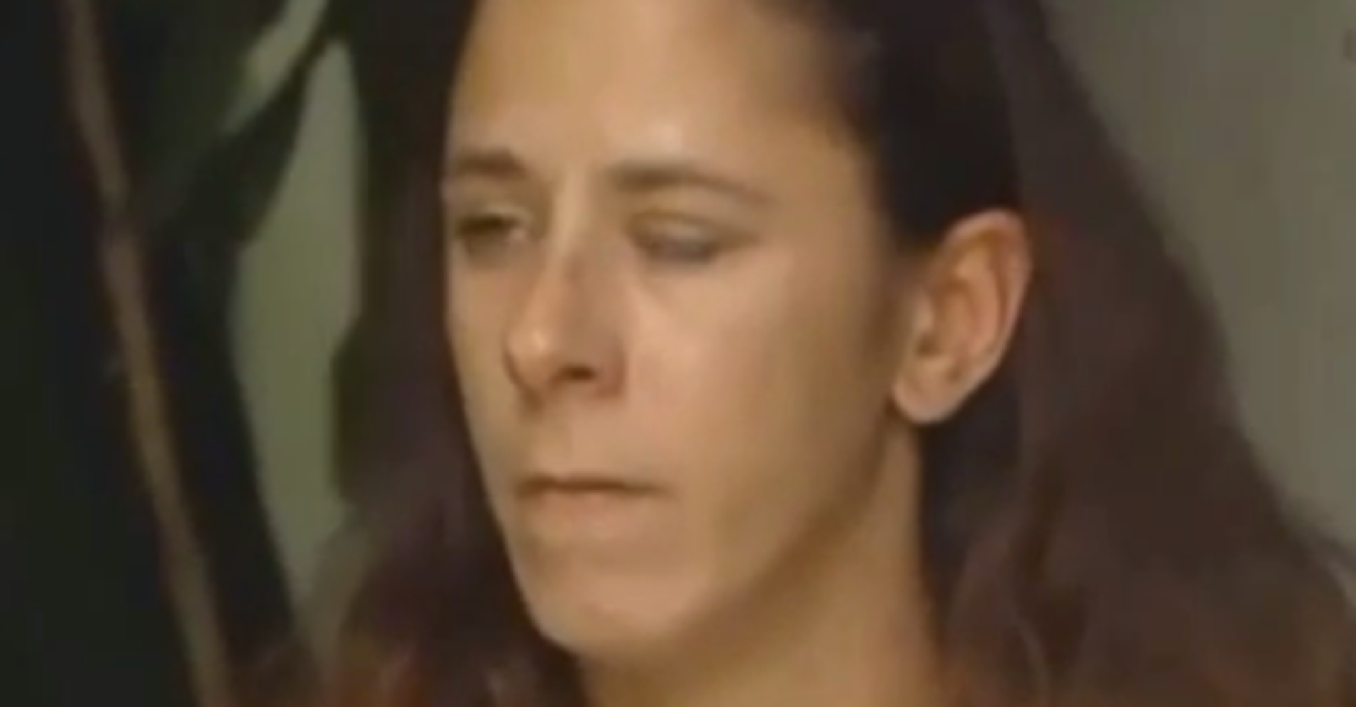 Woman's Eye Sealed Shut After Friend Mistakes Glue For Eye Drops HuffPost