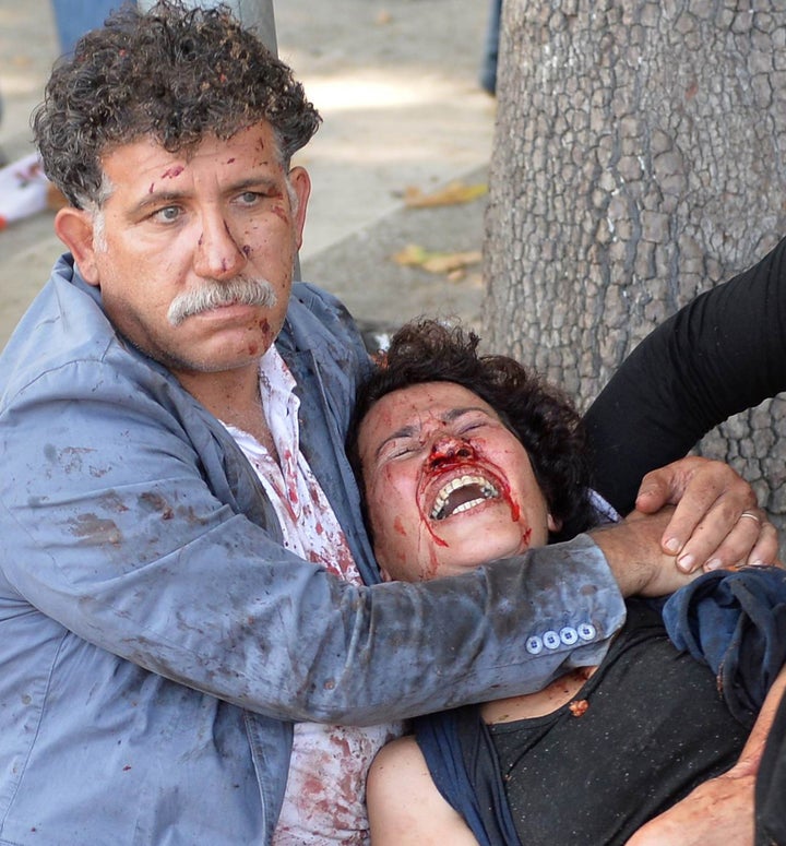 Survivors of the twin blasts that killed at least 95&nbsp;people in Ankara.