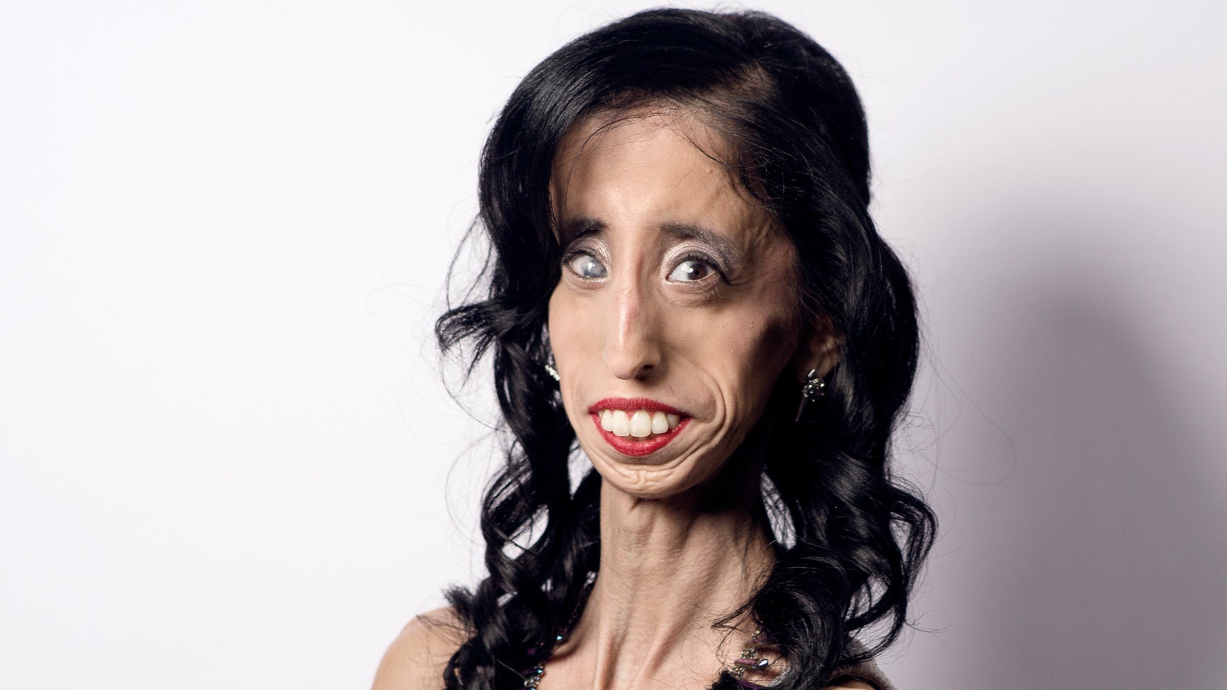 How Being Called The 'World's Ugliest Woman' Transformed Her...