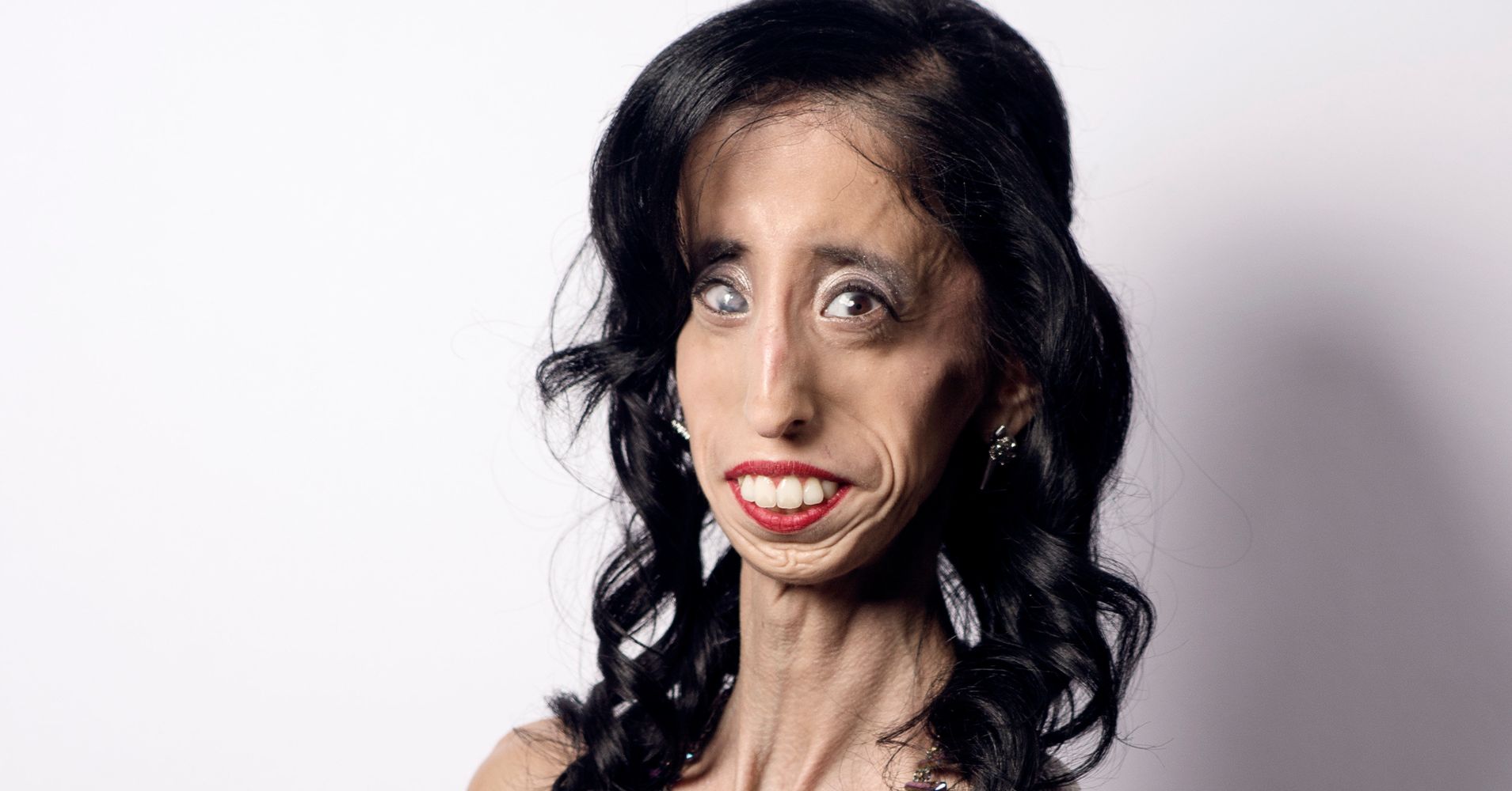 How Being Called The 'World's Ugliest Woman' Transformed Her Life