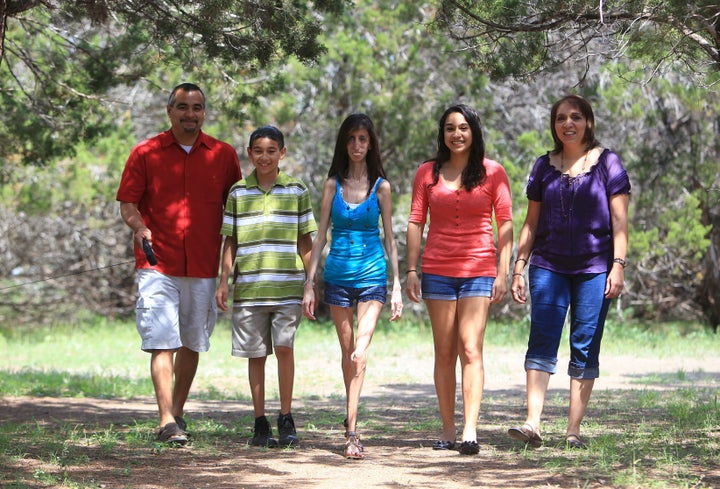 Lizzie Velasquez, age 21, with her father Lupe, brother Chris, sister Marima and mother Rita in 2010 in Austin, Texas.