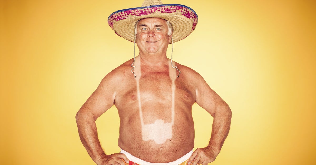 Неудачный задний план. Загар. Смешно загорел. Смешно загорел. Шлем лысая голова.