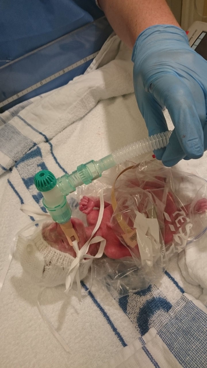 Pixie Griffiths-Grant pictured at the hospital in a Tesco sandwich bag after being born premature.