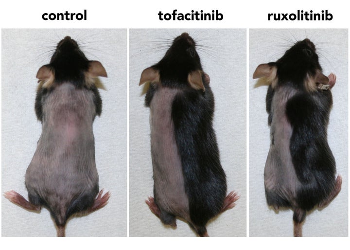 Within three weeks, mice treated topically with a JAK-injibiting drug (ruxolitinib or tofacitinib) had regrown nearly all their hair (right and center photos; the drug was applied only to each mouse's right side). Little to no hair growth occurred in control mice during the same timeframe (left photo).