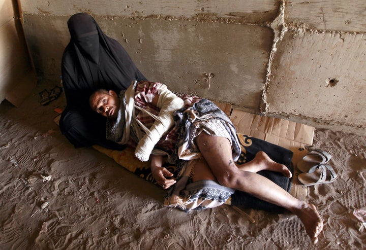 A Yemeni man who was wounded and lost his home because of an airstrike by the U.S.-backed Saudi coalition in the Yemeni capital of Sanaa on April 30.