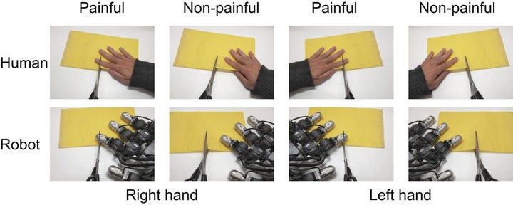 Examples of the painful and non-painful images that researchers used in the study.