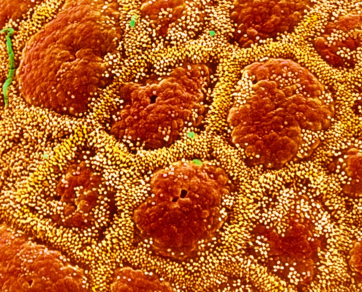 False-color scanning electron micrograph of the mucosa of the stomach, showing the gastric epithelial cells (orange/brown) surrounded by droplets of mucus (yellow). The mucus is a viscous fluid which acts as a protective barrier over the membrane. Food which enters the stomach is broken down into polypeptide fragments by the action of gastric juices released into the lumen. The stomach is protected from autodigestion by this layer of mucus-secreting cells.