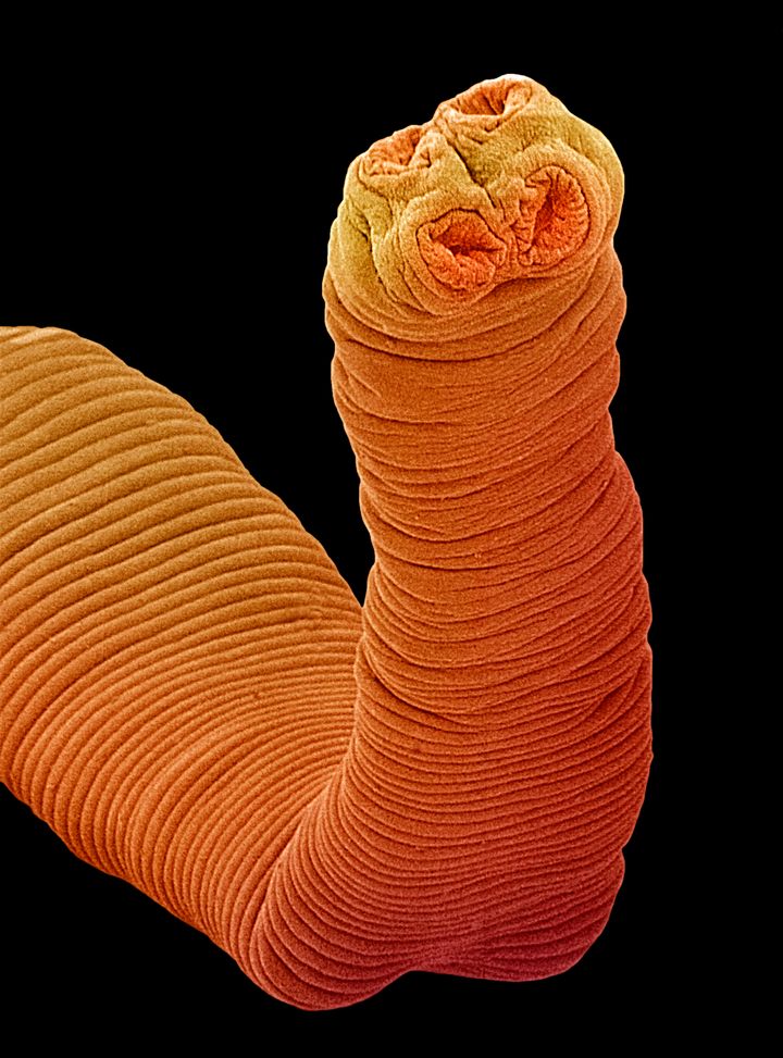 The head of a tapeworm like that found in the Colombian patient is equipped with hooks and suckers for attaching to the host.