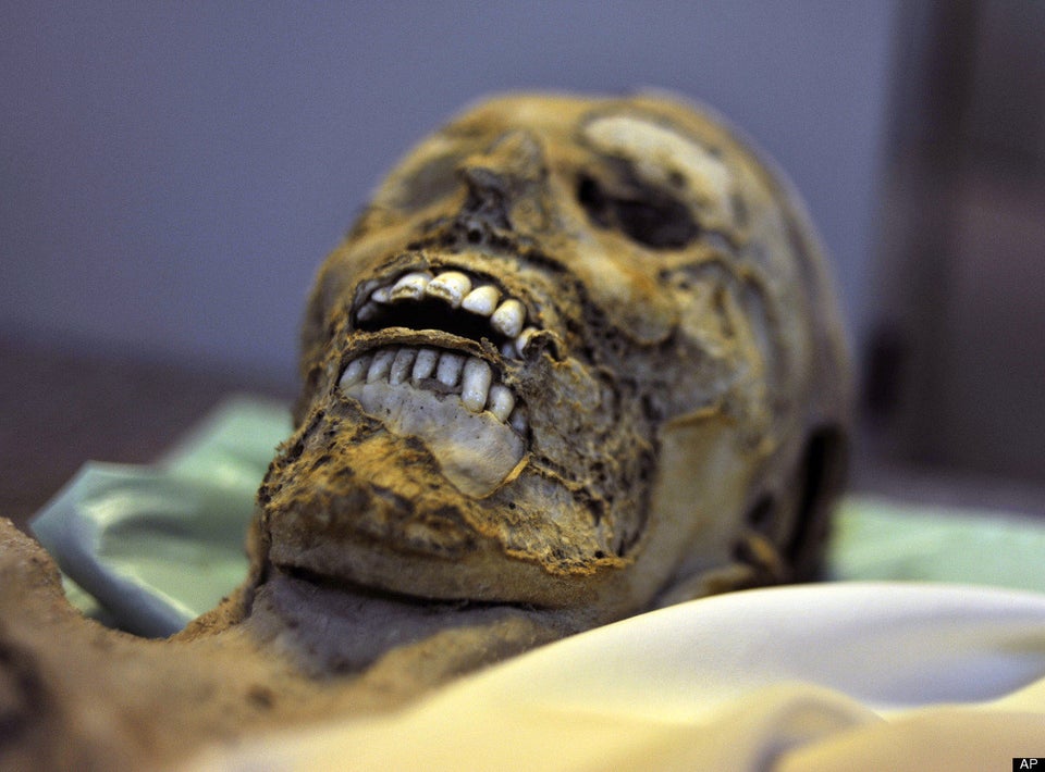 Iceman Mummy Suffered Head Blow Before Death