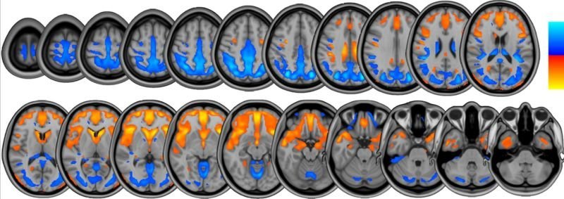 Space Missions Have Major Effects On Astronauts' Brains | HuffPost Impact