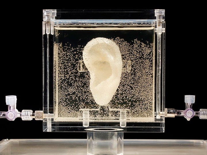 Diemut Strebe, Sugababe (2014). A living bioengineered replica of Vincent van Gogh's ear, grown from tissue engineered cartilage cells procured from a direct male descendant.