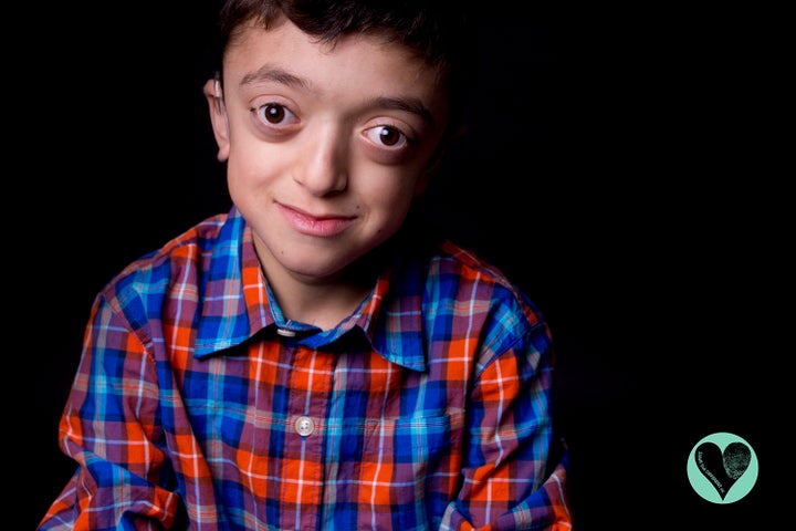 Rarest Disability Photo Series Forces You To Look Beyond Kids' Rare Disabilities ...