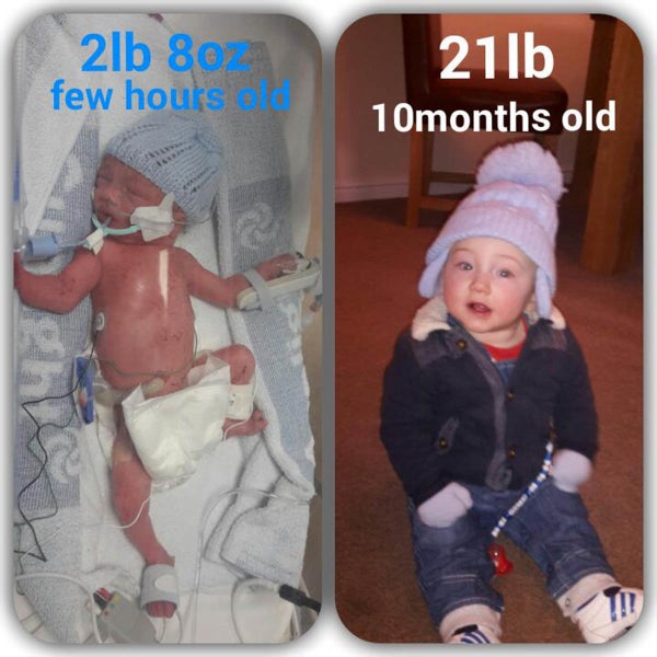 Premature Birth Could Impact Fitness Later In Life HuffPost premature-birth-could-impact-fitness-later-in-life-huffpost
