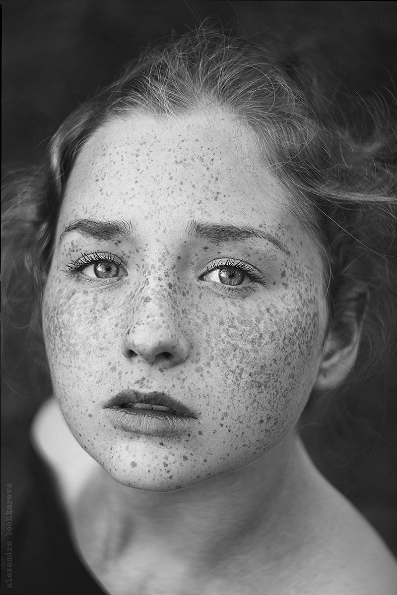 Stunning Images Capture The Beauty Of Freckles | HuffPost