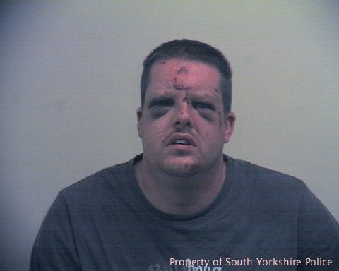 Johnathon Holmes, 35, peers out of two swollen eyes after being pummeled by a woman while attempting to rape her.