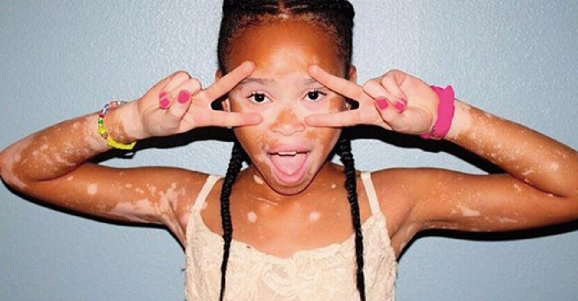 10 Year Old Model April Star Is A Lesson In Self Acceptance Huffpost 1266