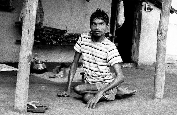 Duniya Oraon, who lives in Jadugoda, has mental and physical disabilities.