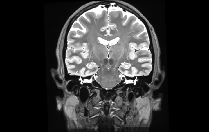 An fMRI scan of Dr. Russell Poldrack's brain, taken as part of his 18-month study.