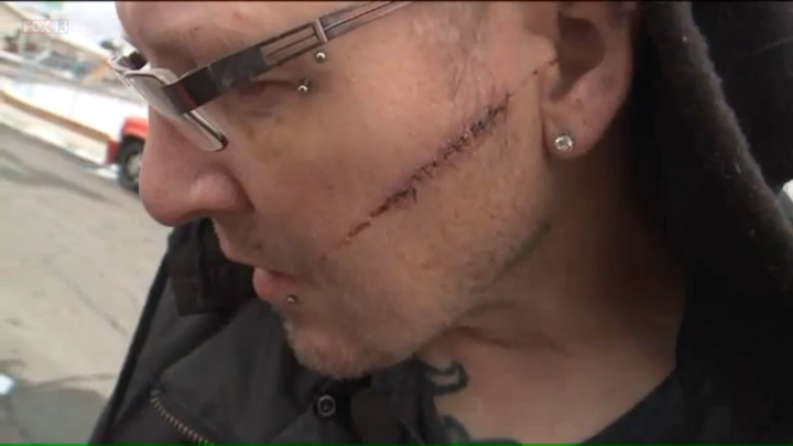 Jason Harper shows a scar across his left cheek from the machete attack in Orem, Utah.