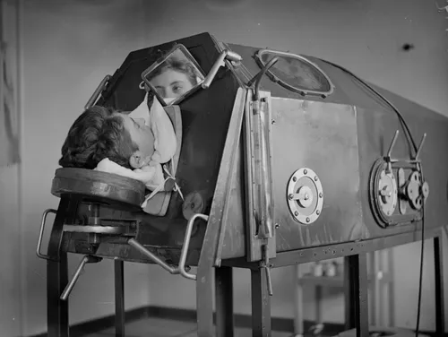 A patient lying in an artificial respiration machine called an iron lung, circa 1938.