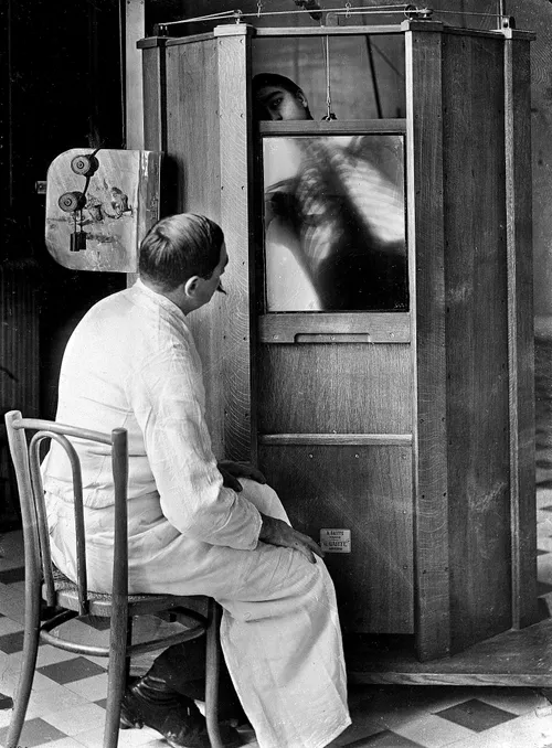 A chest X-ray in progress at Dr. Maxime Menard's radiology department at the Cochin hospital in Paris, circa 1914. Mendard would later lose his finger to side effects from operating the X-ray machine.