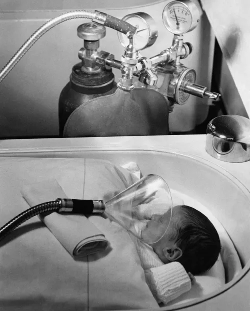 Administering oxygen to a newborn in Berlin, Germany, July 1939.