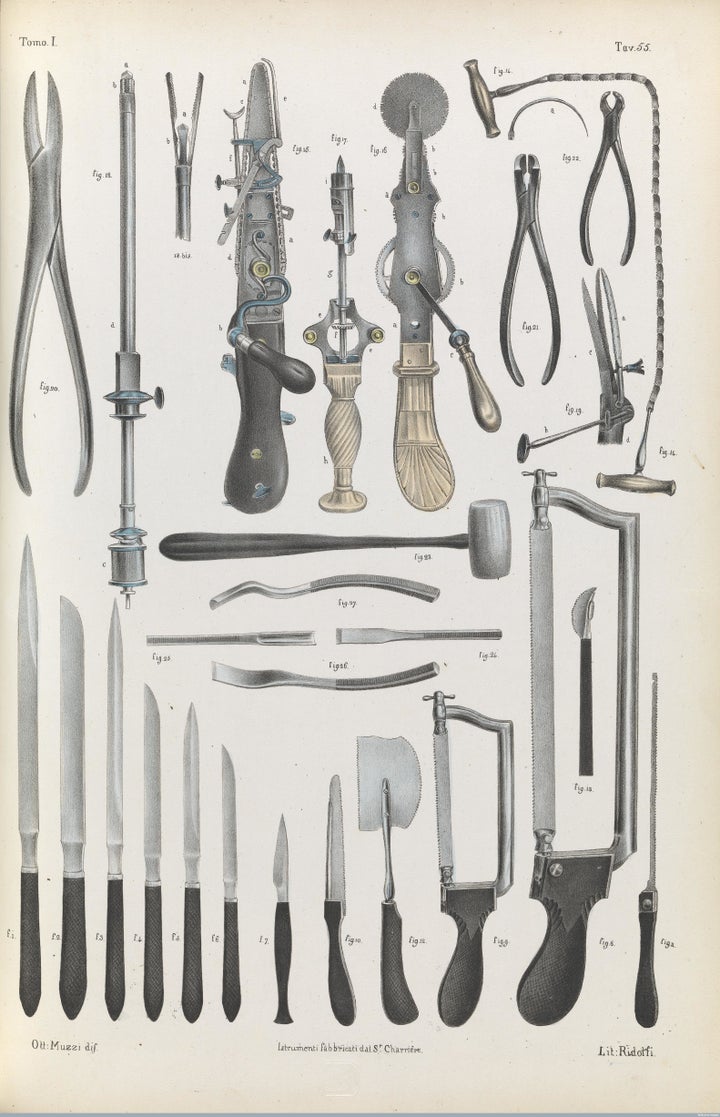 Surgical instruments used for amputation, bone and organ operations, 1841.