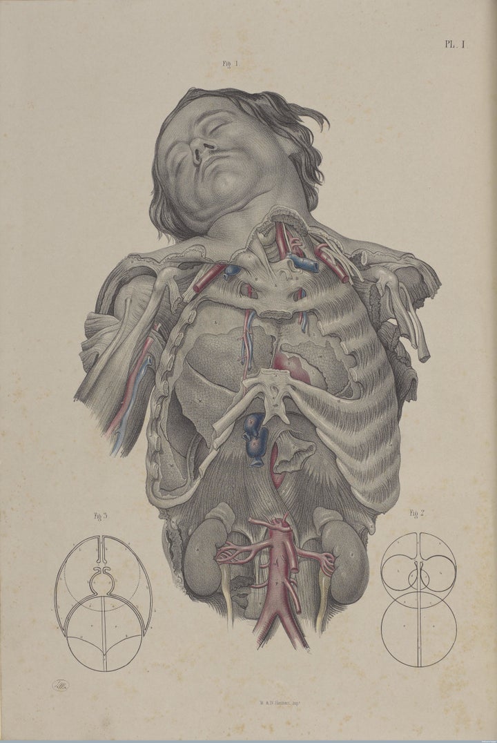 Dissecting the thorax to reveal the lungs, heart and primary blood vessels, 1856.