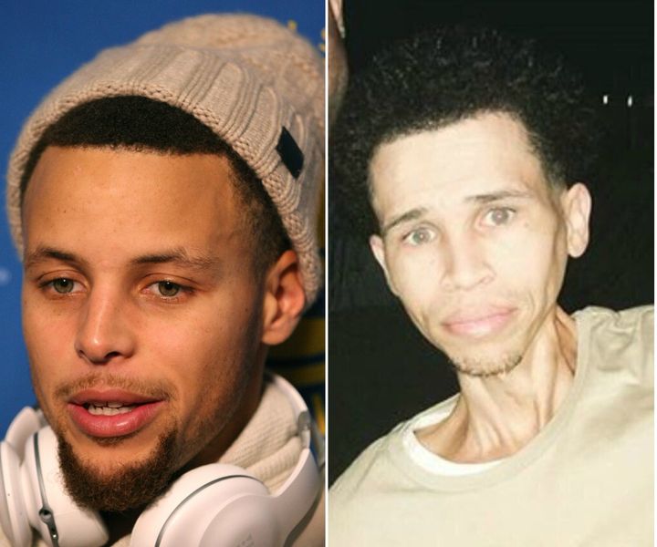 Social media users got a laugh out of comparing Stephen Curry to 31-year-old Leon Mitchell, but the story behind Mitchell's appearance is no laughing matter.
