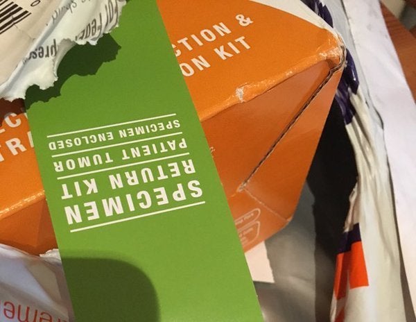 James Potten of Bristol, England snapped a photo of this surprise he found in a FedEx package last week.