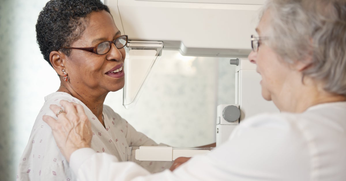 When Should You Get A Mammogram? A Definitive Guide HuffPost Life
