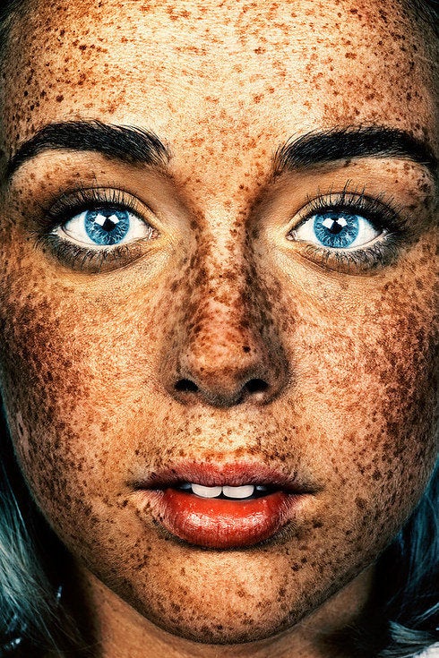 The Fabulously Freckled Get Their Close Up In Photo Project Huffpost 