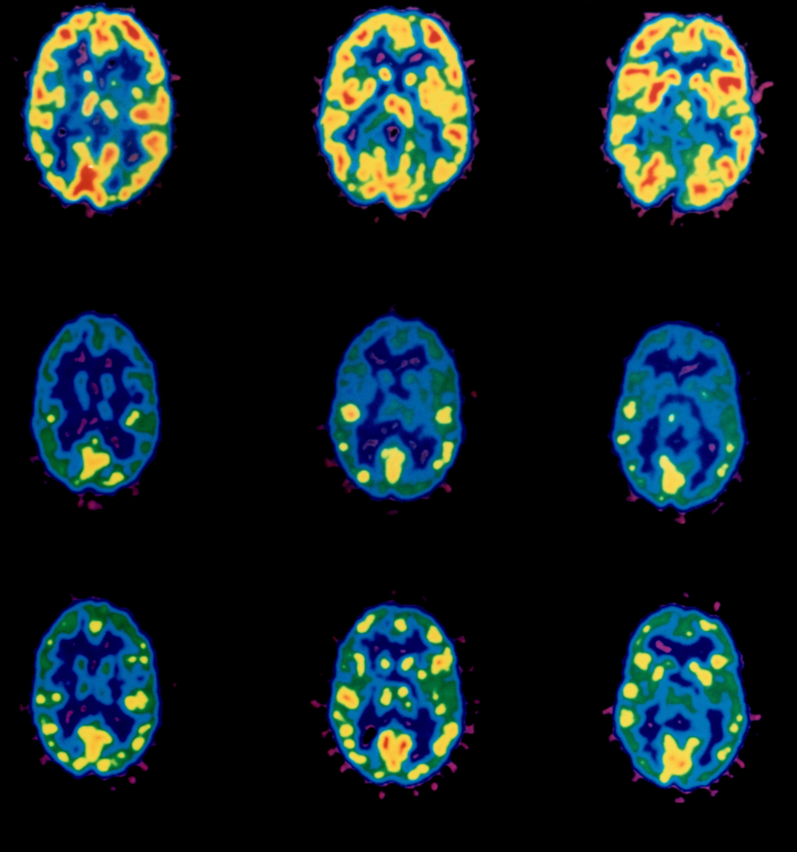 thebrain 11 crack