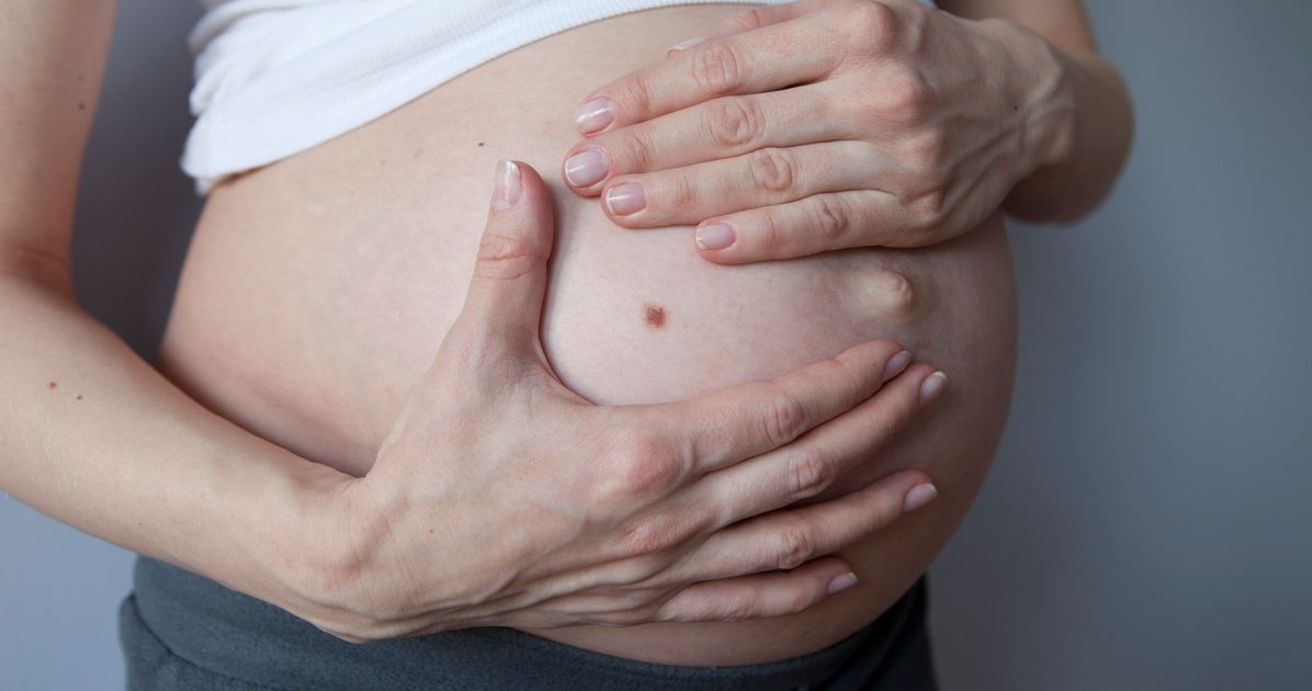 Родинки на животе у беременных