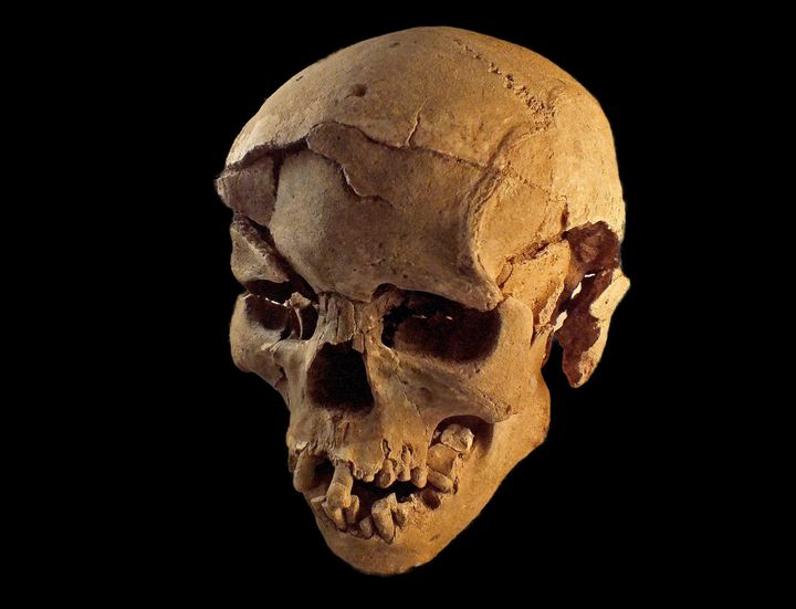 A skull with multiple fracture wounds, likely made by a blunt instrument such as a club.
