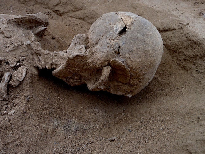 Skull of a man with multiple lesions on the side, probably caused by a club. Image by Marta Mirazon Lahr, enhanced by Fabio L