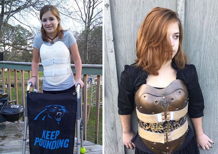 Crash Survivor Makes Back Brace Incognito, Turns It Into Steampunk Armor