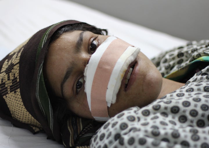 Reza Gul recovers from the most vicious of a series of attacks from her husband in her hospital bed in Mazar-e-Sharif on Wednesday. She hopes to receive reconstructive surgery abroad.