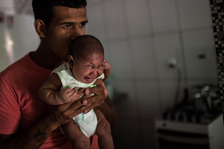 The virus was believed to be relatively benign until the outbreak in Brazil was linked to a sharp increase in cases of microcephaly, which can cause shrunken brain size in newborns. 