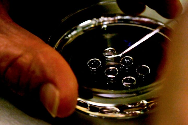 Human embryos being placed onto a petri dish.