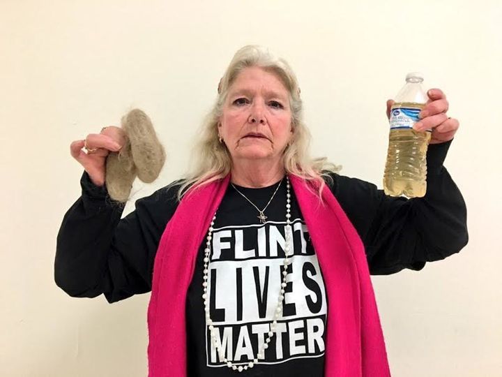 Gladyes Williamson, 62, holds clumps of hair that fell out while taking showers during the Flint water crisis and a bottle of discolored water from her home sink.