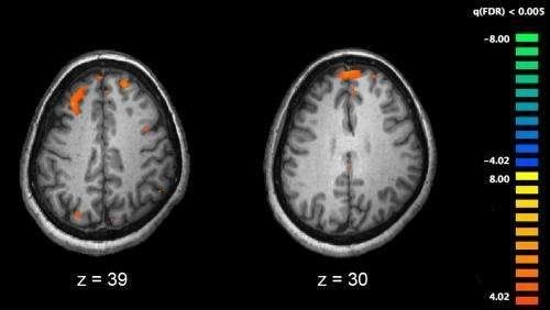 fMRI brain scans show differences in brain activity in people diagnosed with schizophrenia.