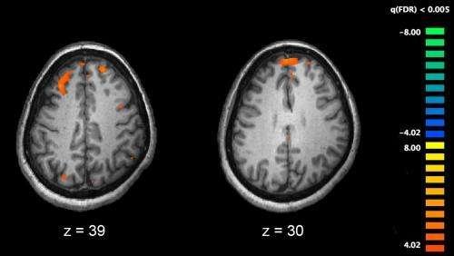 fMRI brain scans show differences in brain activity in people diagnosed with schizophrenia.