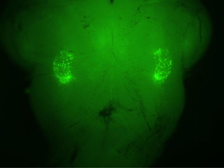 On each side of the brain stem, a florescent-green marker illuminates the two networks of 200 neurons that control the sighing reflex.