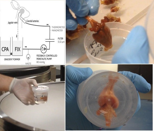 A rabbit brain is seen bring cryogenically preserved by a new chemical technique called Aldehyde-stabilized cryopreservation.